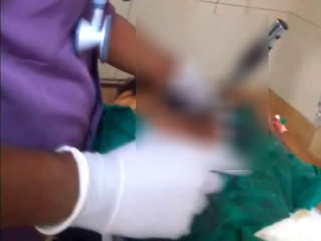 Videos : नशेड़ी पति ने पत्‍नी की पीठ में घोंपा खंजर, 32 घंटे बाद हुई सफल सर्जरी