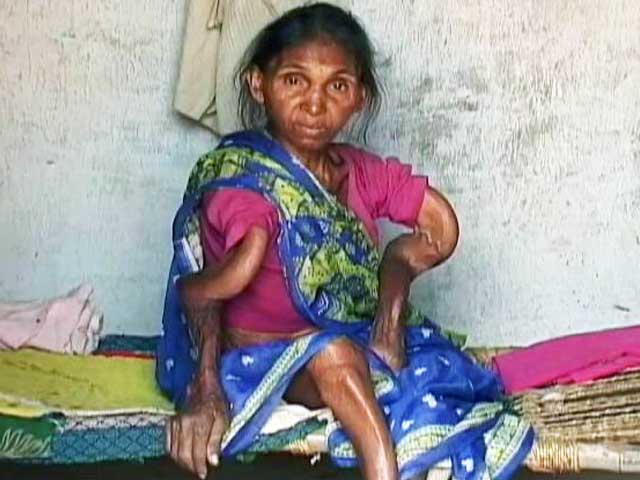 हर जिंदगी जरूरी है : झारखंड के गांव में प्रदूषित पानी से आफत में लोगों की जान