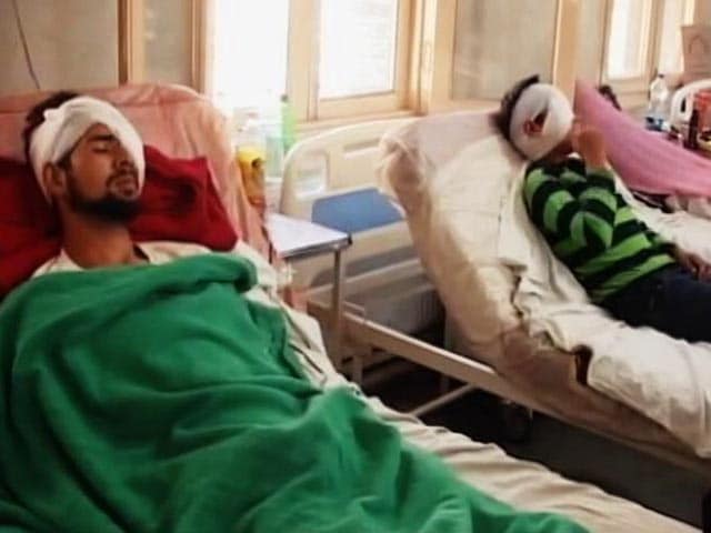 Video : As Kashmir Hospitals Struggle With Eye Injuries, Centre Rushes Doctors' Team