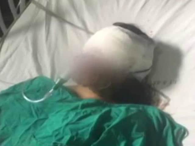 Video : 14-Year-Old Insha: The Face Of Debate Over Use Of Pellet Guns In Kashmir