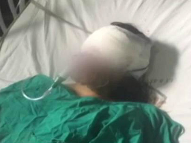 14-Year-Old Insha: The Face Of Debate Over Use Of Pellet Guns In Kashmir