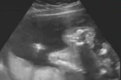Supreme Court Agrees To Hear Plea Of Rape Victim Challenging Abortion Law Supreme Court Agrees To Hear Plea Of Rape Victim Challenging Abortion Law