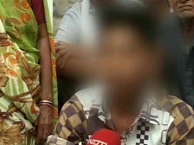 दलित पिता ने मृत पशु उठाने का काम छोड़ा तो उसके नाबालिग बेटे को बेरहमी से पीटा