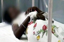 यूपी के बुलंदशहर में रेप पीड़िता पर बलात्कार के आरोपियों ने फेंका एसिड यूपी के बुलंदशहर में रेप पीड़िता पर बलात्कार के आरोपियों ने फेंका एसिड