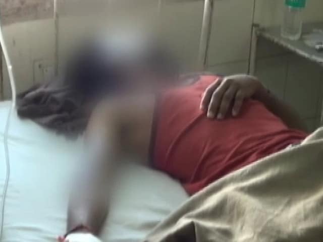 Video : हरियाणा : हिसार में दबंगों ने दलित से मारपीट के बाद एसिड से हमला किया