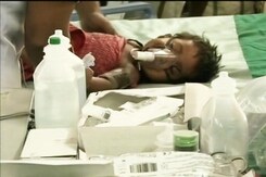 Toxic Beans Suspected Behind Odisha Deaths, Not Japanese Encephalitis Toxic Beans Suspected Behind Odisha Deaths, Not Japanese Encephalitis