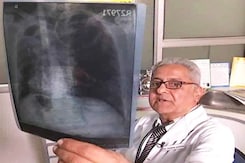 Under Daily Dose TB Treatment, Drugs To Be Given As Per Patient's Weight Under Daily Dose TB Treatment, Drugs To Be Given As Per Patient's Weight