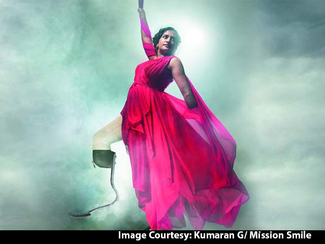 13 Amputees Break Beauty Stereotype, Now They Are Calendar Girls And Boys