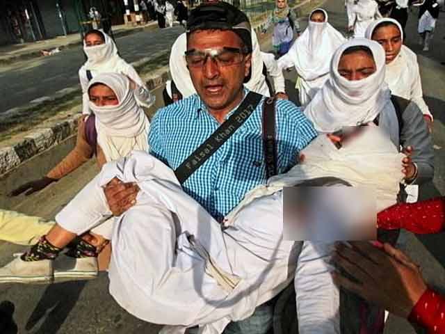 इंसानियत सबसे बड़ा फर्ज : प्रेस फोटोग्राफर ने फोटो खींचने के बजाय घायल छात्रा की मदद की