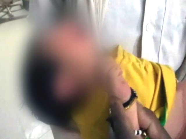 मध्य प्रदेश : सरकारी अस्पताल में चूहे ने नवजात बच्ची की उंगली कुतरी मध्य प्रदेश : सरकारी अस्पताल में चूहे ने नवजात बच्ची की उंगली कुतरी