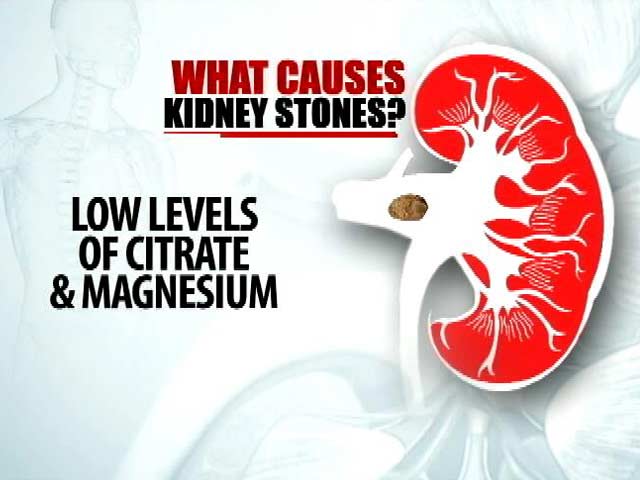 Learn About How To Prevent Kidney Stones