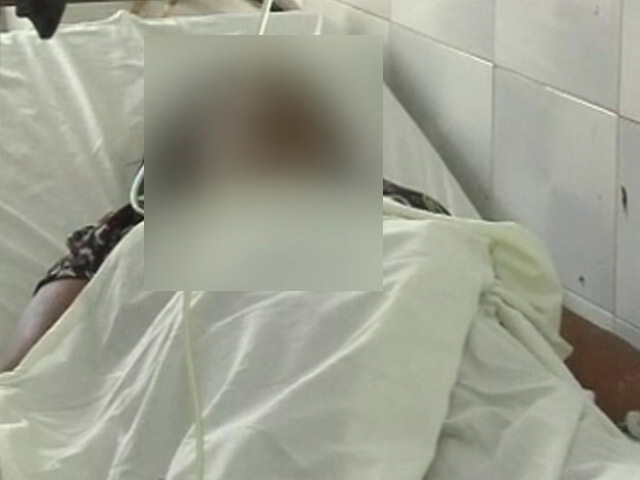 UP में गैंगरेप और एसिड अटैक से जिंदा बची महिला पर फिर एसिड अटैक