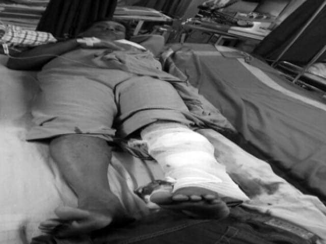 CPM Worker Attacked In Kerala's Kannur, Severely Injured