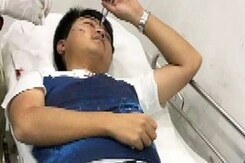 बेंगलुरु में लूट के लिए एक चीनी नागरिक पर चाकू से हमला बेंगलुरु में लूट के लिए एक चीनी नागरिक पर चाकू से हमला