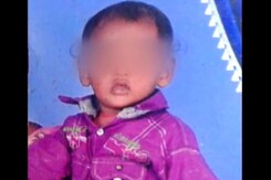 4-Year-Old Boy Mauled By Stray Dogs Dies In Andhra Pradesh's Guntur 4-Year-Old Boy Mauled By Stray Dogs Dies In Andhra Pradesh's Guntur