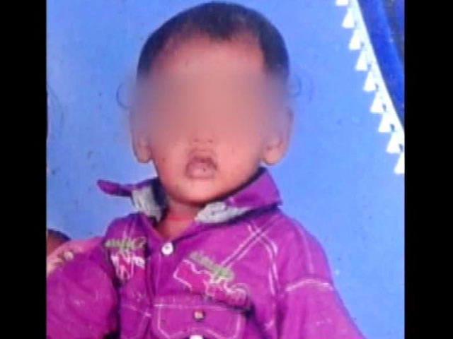 4-Year-Old Boy Mauled By Stray Dogs Dies In Andhra Pradesh's Guntur