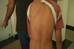 10-Year-Old Beaten Up Allegedly By Teachers At Ludhiana's Ryan International School 10-Year-Old Beaten Up Allegedly By Teachers At Ludhiana's Ryan International School