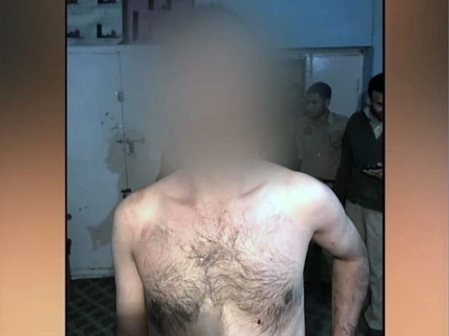 40 Braids Chopped Off In Kashmir, Creates A New Security Problem