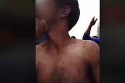 Mentally Challenged Man Beaten Up In Kashmir Over Braid-Chopping Rumours Mentally Challenged Man Beaten Up In Kashmir Over Braid-Chopping Rumours