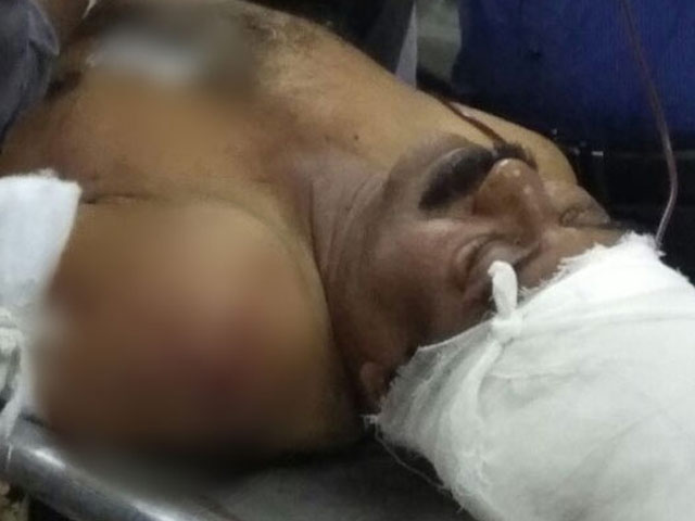 2 CPM Workers Attacked In Kerala, Police Hunt For Assailants