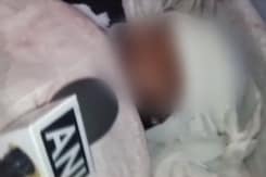 13-Year-Old Girl Set On Fire For Resisting Sexual Assault, Boy Detained 13-Year-Old Girl Set On Fire For Resisting Sexual Assault, Boy Detained