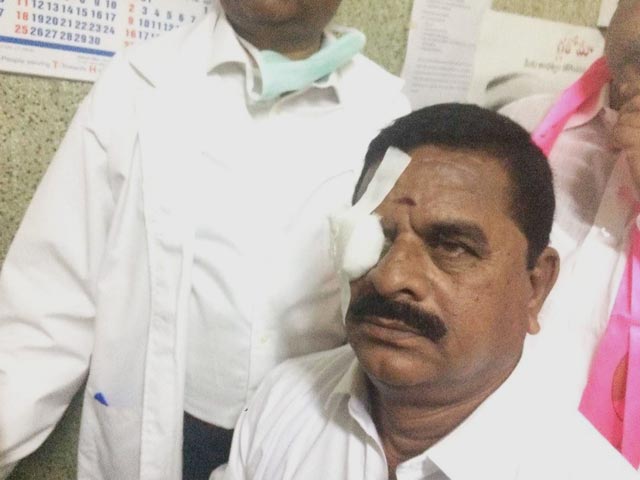 Congress Lawmaker Threw Headphone In Telangana Assembly. It Hit Council Head's Eye