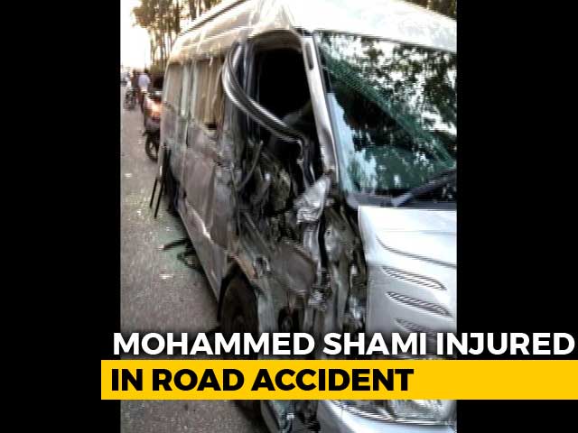 Video : Mohammed Shami Involved In Road Accident, Suffers Head Injury