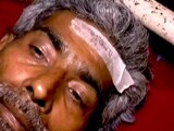 Videos : बिहार : घायलों के माथे पर चिपकाया गया 'भूकंप' लिखा स्टीकर
