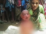 Video : Newborn Forced to Walk by Witch Doctor in Assam Village as Fever Cure