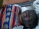 Video : Tribal Activist Soni Sori Attacked With 'Acid-Like Chemical' In Chhattisgarh