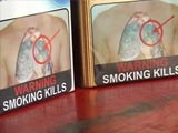 Video : Tobacco Warnings: Smoking Kills, Yet India Drags Feet