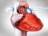 Video: Understanding the Basics About Heart Stents