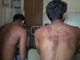 Video : Dalit Men Beaten Up By 25 People Allegedly For Overtaking In Maharashtra