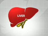 Video: Indians Are More Prone To Hepatic Steatosis Or Fatty Liver Disease