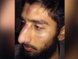 Video : 2 Kashmiri Students Assaulted By Mob In Haryana After Friday Prayers