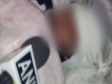 Video : 13-Year-Old Girl Set On Fire For Resisting Sexual Assault, Boy Detained